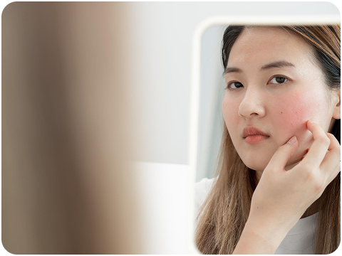 敏感肌、容易泛紅發炎者