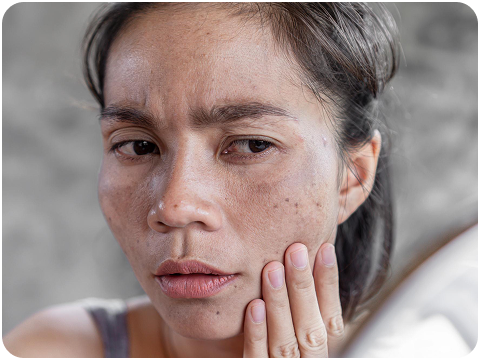 膚色暗沉、代謝慢